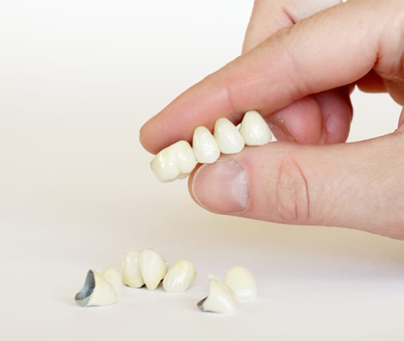 dental crowns in winnipeg