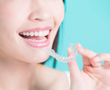 top things you should know before acquiring invisalign