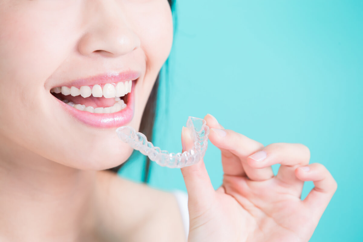 top things you should know before acquiring invisalign
