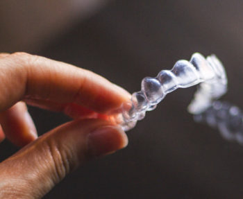 doubts about invisalign you always wanted to have cleared