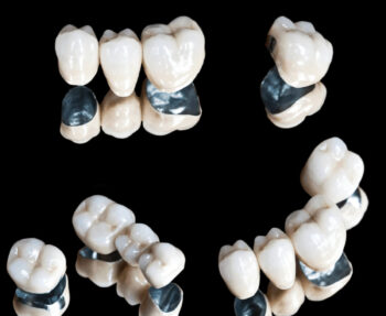 busting myths about dental crowns