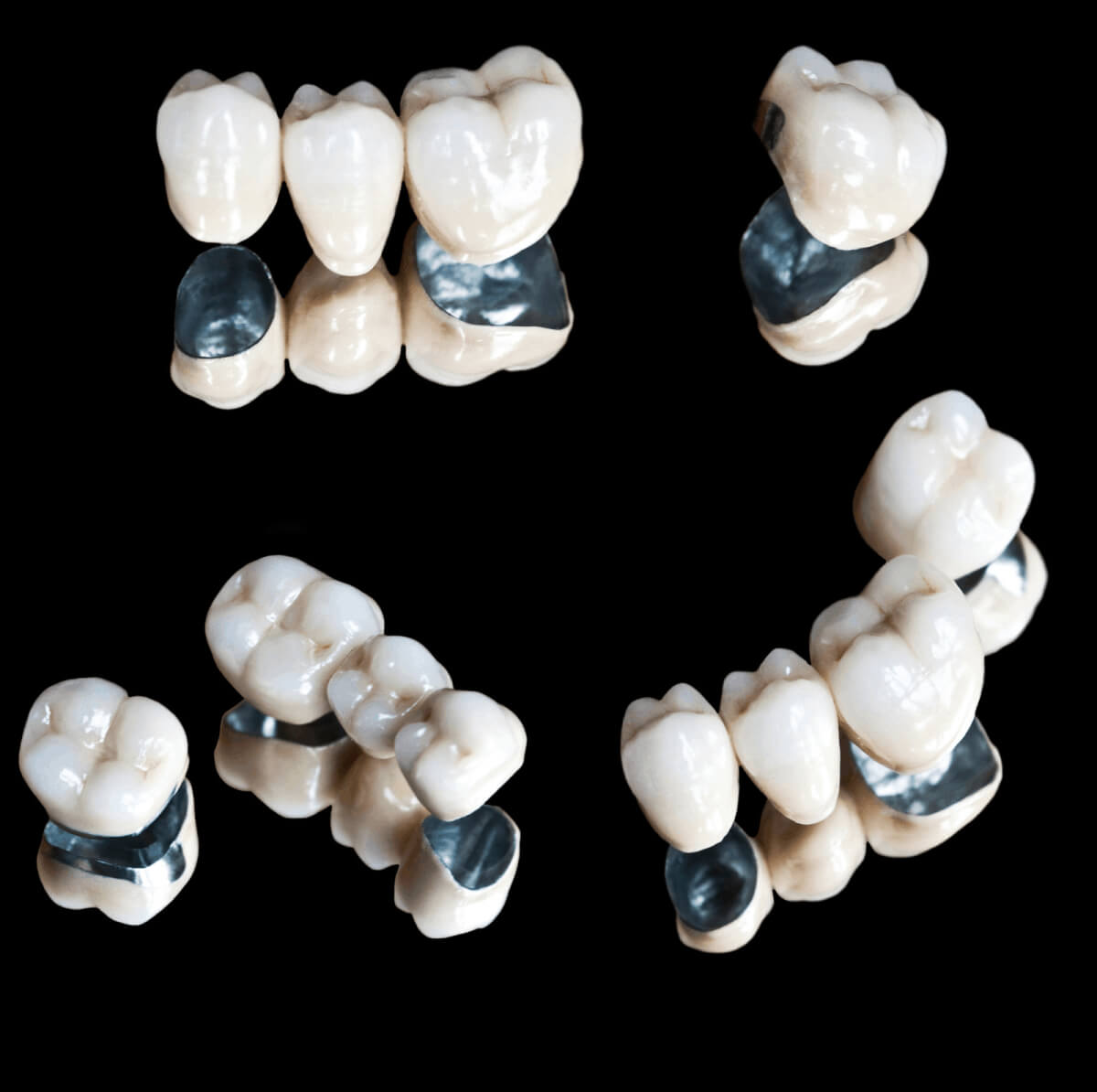 busting myths about dental crowns