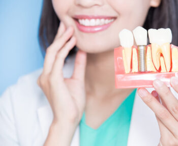 are dental implants worth it