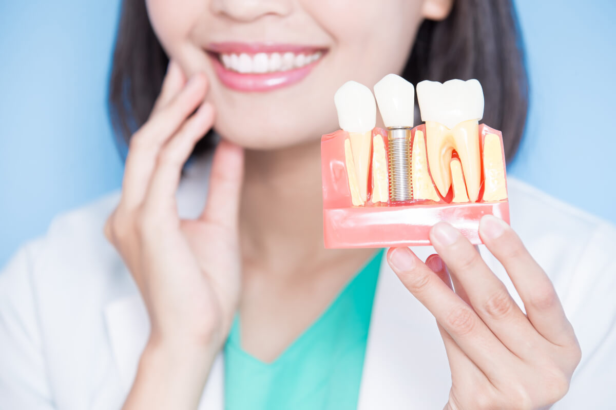 are dental implants worth it