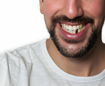 what are the best ways to replace missing teeth