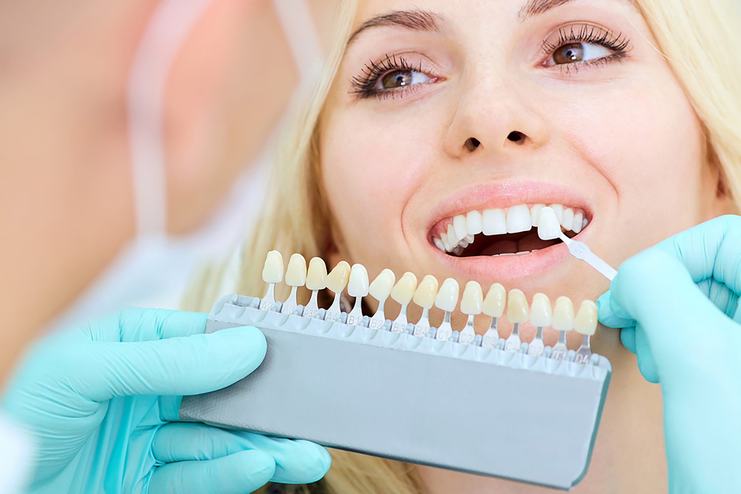 teeth whitening treatment near me